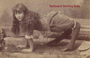 backwardknee